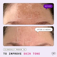 Major Fade Dark Spot Starter Kit