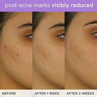 Brightening & Firming Vitamin-C Serum with Ferulic Acid