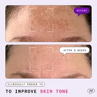 Major Fade Hyper Serum Dark Spot Treatment