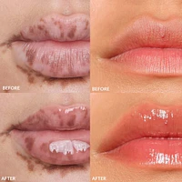 Mini Lip Gloss Set