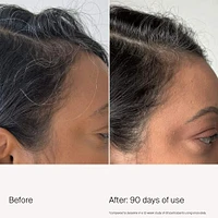 Scalp Care Density Serum for Thinning & Greying Hair