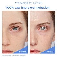 ATOBARRIER365 Lightweight Face Lotion Moisturizer with Ceramides & Niacinamide for Skin Moisture Barrier Repair