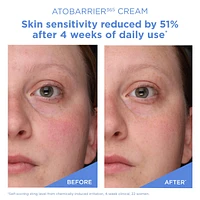 Mini ATOBARRIER365 Cream Moisturizer with Ceramides & Niacinamide for Skin Moisture Barrier Repair