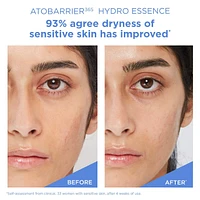 ATOBARRIER365 Hydro Essence with Hydrating Amino Acids for Skin Moisture Barrier Repair