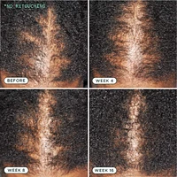 Density Nourishing Actives Scalp Serum for Hair Growth