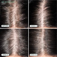 Density Nourishing Actives Scalp Serum for Hair Growth