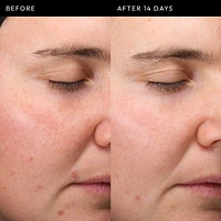 Exosome Hydro-Glow Complex Serum
