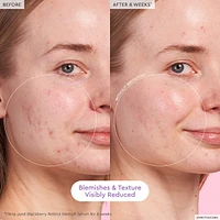 Glass Skin Hydration Kit
