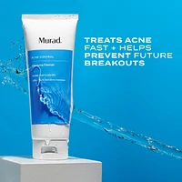 Clarifying Gel Cleanser with Dual Salicylic Acid for Acne-Prone Skin