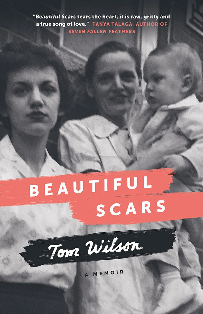 Beautiful Scars - Édition anglaise