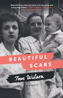 Beautiful Scars - Édition anglaise