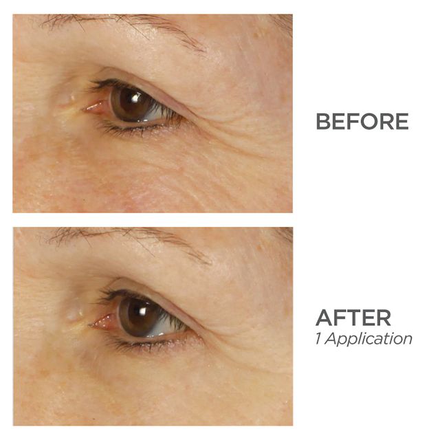 BeautyBio Bright Eyes CollagenInfused Brightening Colloidal Silver Eye