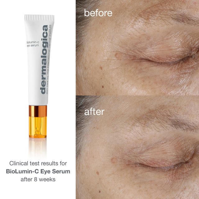 Dermalogica BioluminC Vitamin C Eye Serum Mall of America®