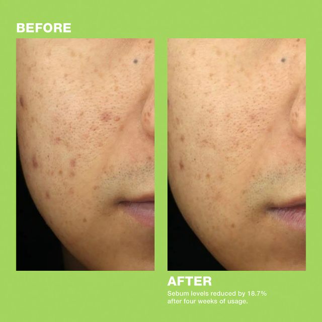 Dr. Jart+ Teatreement™ Moisturizer | Mall of America®