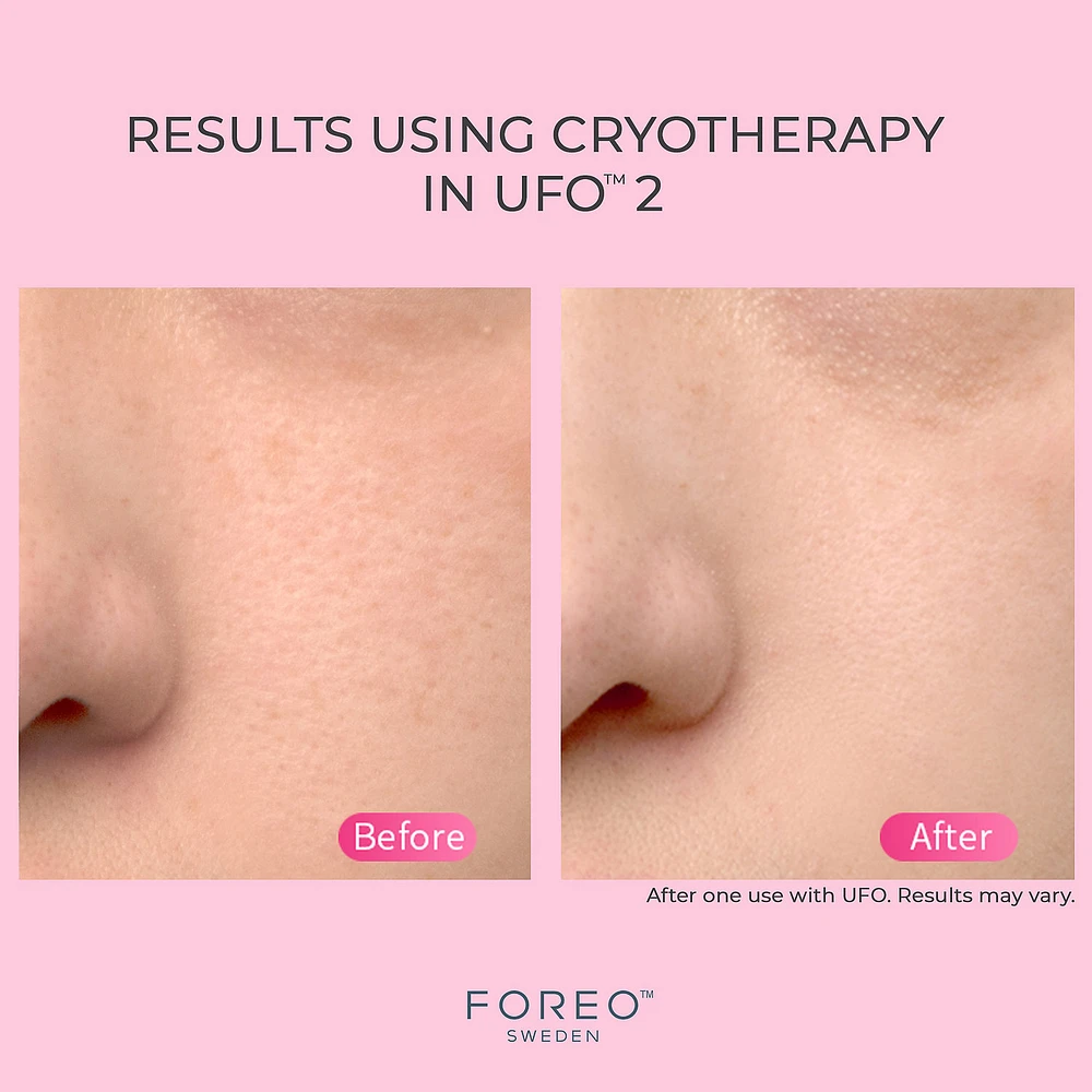 海外セレブ愛用 フェイシャルビューティースパ FOREO UFO TM FOREO UFO™ 2 | Arden Fair