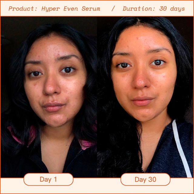 Hyper Skin Brightening Dark Spot Vitamin C Serum Mall of America®