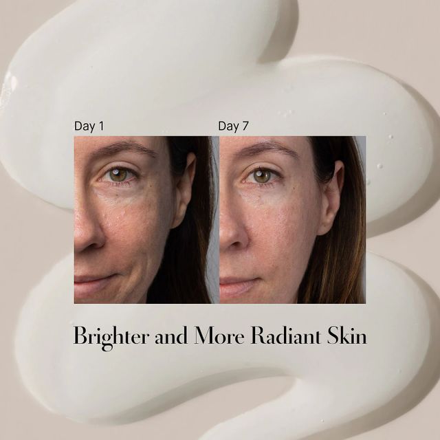 Shani Darden Skin Care Lactic Acid AHA Exfoliating Serum The Summit