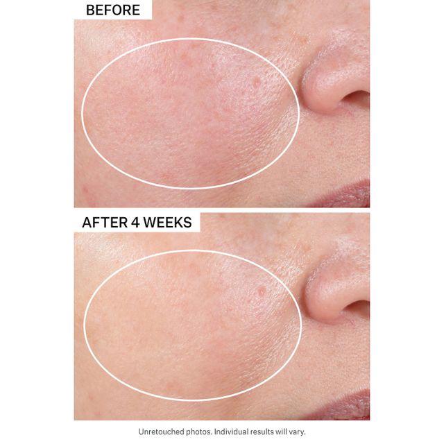 StriVectin Advanced Retinol Nightly Renewal Face Moisturizer with